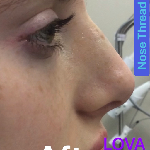 Explore cool stick and poke tattoo ideas, creative tattoo ideas in Lake Oswego, available at Lake Oswego Vein and Aesthetic LOVA