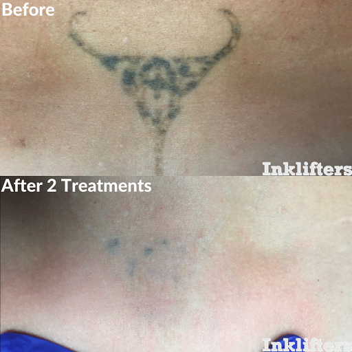 Explore rising phoenix tattoo ideas, creative tattoo ideas in Pleasant Grove, available at Inklifters Tattoo Removal