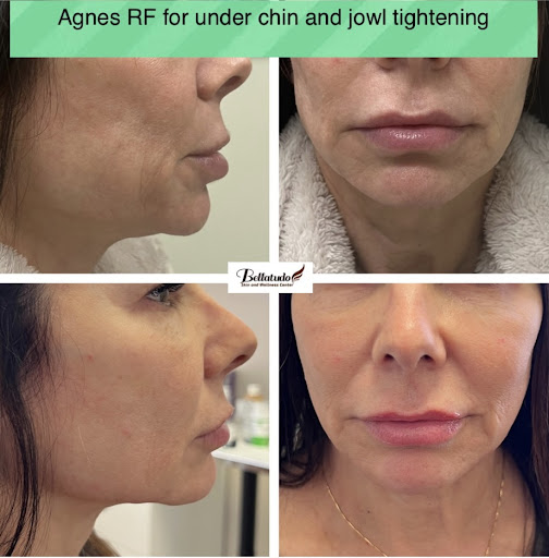 Bellatudo Skin and Wellness Center image