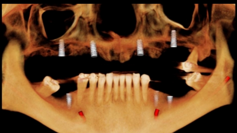 Dra Claudia Leon Periodoncia e Implantologia Oral