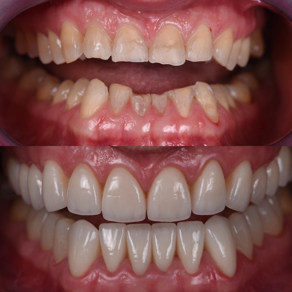 DentalFlex Clínica Dental Especializada