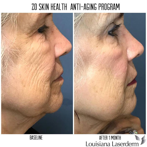 Explore oregon tattoo ideas, creative tattoo ideas in Baton Rouge, available at Louisiana Laserderm