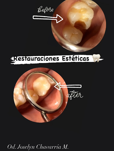 CONSULTORIO DENTAL - DRA. MIRIAM MARTÍNEZ TOMALÁ - Dentista