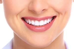 V Smile Dental Center image
