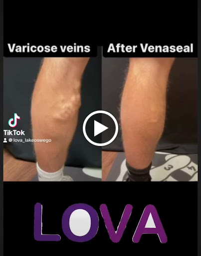 Explore realism tattoo ideas, creative tattoo ideas in Lake Oswego, available at Lake Oswego Vein and Aesthetic LOVA