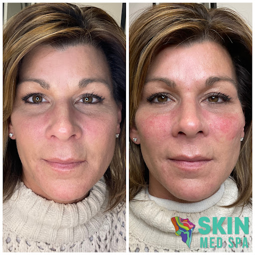 Explore north carolina tattoo ideas, creative tattoo ideas in Downers Grove, available at Skin Med Spa