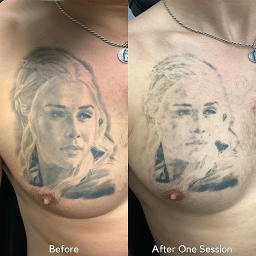 Explore spring tattoo ideas, creative tattoo ideas in Houston, available at Removery Tattoo Removal & Fading