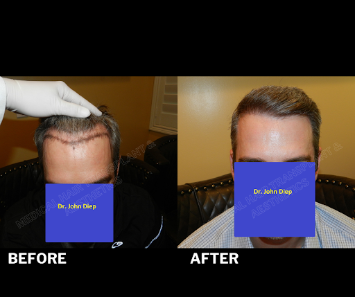 Medical Hair Transplant & Aesthetics image
