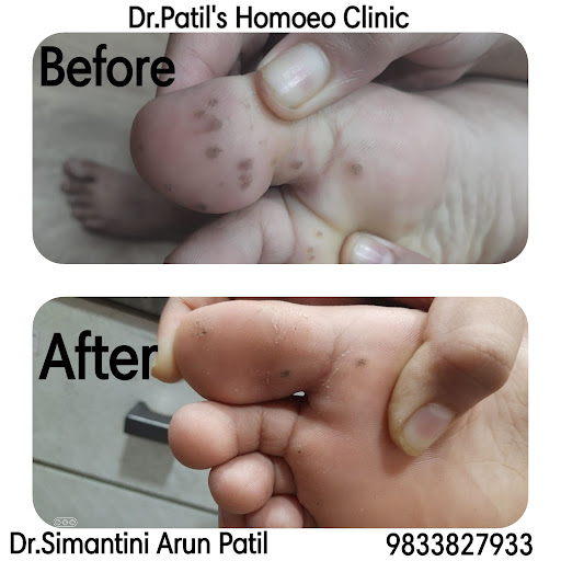 Dr Patils Homoeo Clinic