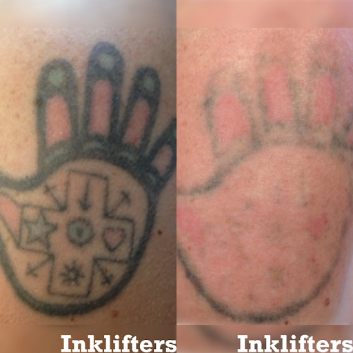 Explore body tattoo ideas, creative tattoo ideas in Pleasant Grove, available at Inklifters Tattoo Removal