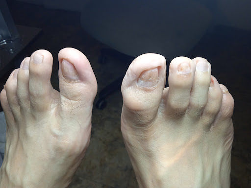 Ultra Feet Care