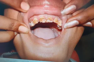 VARDHMAN DENTAL CLINIC Dr Peeush Jain - Best Good Dentist | Root Canal Treatment | Top Three Dentist in Saharanpur image