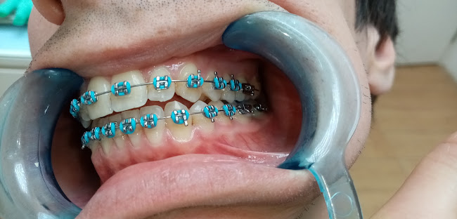 Opiniones de Consultorio odontologico integral en Paso Carrasco - Dentista
