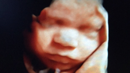 Unborn Images 3D 4D Ultrasound Studio