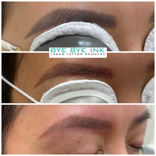 Explore linework tattoo ideas, creative tattoo ideas in Middle Village, available at Bye Bye Ink Laser Tattoo Removal