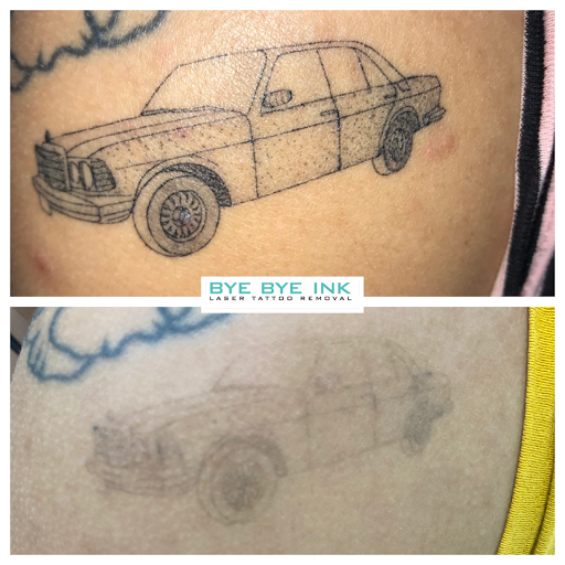 Explore biker tattoo ideas, creative tattoo ideas in Middle Village, available at Bye Bye Ink Laser Tattoo Removal