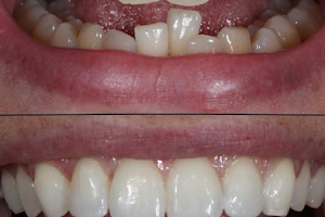 Tooth Booth- Braces & Implant Dental Centre image