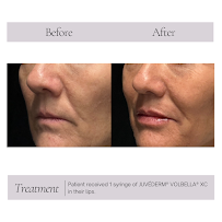 Dermacare Med Spa in Carlsbad - Photo 9 - Car repair in Carlsbad, CA, Carlsbad