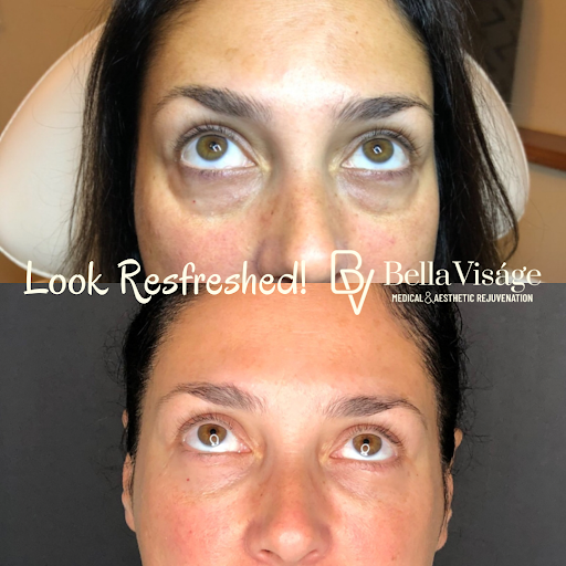 Explore mental health awareness tattoo ideas, creative tattoo ideas in Lakeland, available at Bella Visge Medical & Aesthetic Rejuvenation