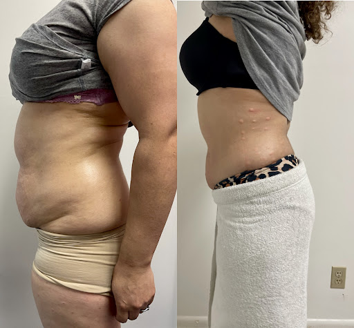 Explore stick season tattoo ideas, creative tattoo ideas in Savannah, available at Haute Brows. Cosmetic Tattoo