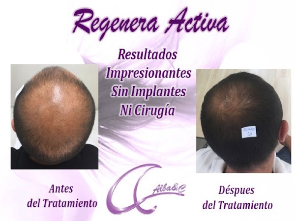 Imagen de Clínica Flebología y Medicina Estética AlbaC (9 de 14)