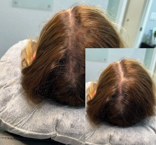 Explore tattoo ideas ribs, creative tattoo ideas in Roseville, available at NuHair Ink. Scalp MicroPigmentation & Aesthetic Clinic of Sacramento