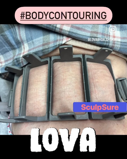 Explore guns and roses tattoo ideas, creative tattoo ideas in Lake Oswego, available at Lake Oswego Vein and Aesthetic LOVA