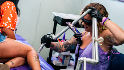 Explore tattoo shade ideas, creative tattoo ideas in Lake Jackson, available at Second Chance Laser Tattoo Removal