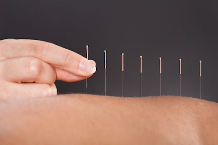 5E Wellness Lab - Acupuncture Northampton - 5E Wellness Lab - Acupuncture Northampton