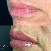 It Aesthetix - Photo 3 - Car repair in Whitehall Township, PA, Allentown