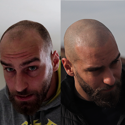 Photo n°19 de Tricopigmentation Toulouse à Montlaur ()