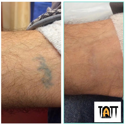 Explore tattoo ideas female side, creative tattoo ideas in Fort Myers, available at Laser Tattoo Removal by Tatt Cemetery