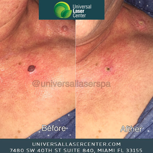 Laser Hair Removal Service «Universal Laser Center®», reviews and photos, 7480 SW 40th St #840, Miami, FL 33155, USA