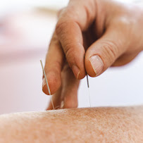 Brucker Acupuncture and Natural Medicine - Photo 3 - Car repair in Elkins Park, PA, Philadelphia