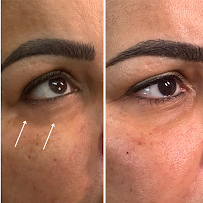 Lé Nour Medspa - Car repair in Scottsdale, AZ, Scottsdale - Rated 5.0/5