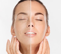 Urban Skin Care Dallas: Facials, Chemical Peels, & Microneedling - Photo 4 - Car repair in Carrollton, TX, Carrollton