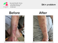 Acumedi Health Clinics Inc - Photo 9 - Car repair in Granada Hills, CA, Santa Clarita