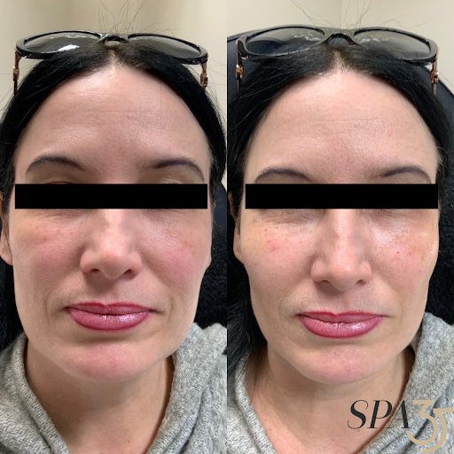 Explore soccer ball tattoo ideas, creative tattoo ideas in Boise, available at Spa 35 Med Spa