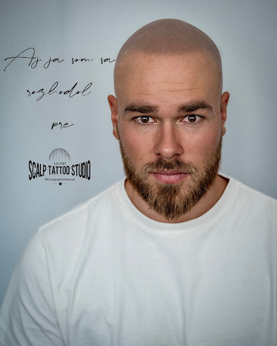 Scalp Tattoo Studio - Scalp Tattoo Studio