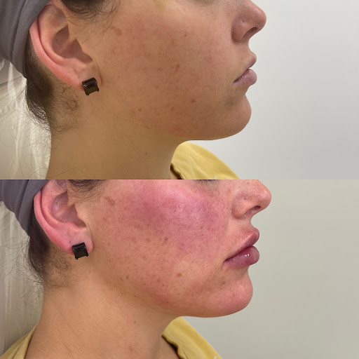 Explore sand dollar tattoo ideas, creative tattoo ideas in Owensboro, available at The Skin Lab