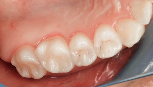 Cheslyn Hay Dental Practice - Cheslyn Hay Dental Practice