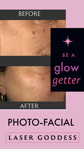 Explore dainty spine tattoo ideas, creative tattoo ideas in Bayside, available at Laser Goddess