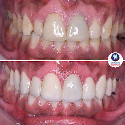 Alsahry Dental & Maxillofacial Center | مركز السهري للأسنان