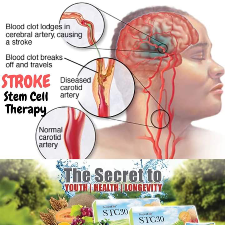 STEMCELL WORLD