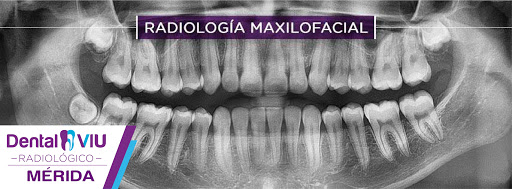 Dental Viu Radiológico