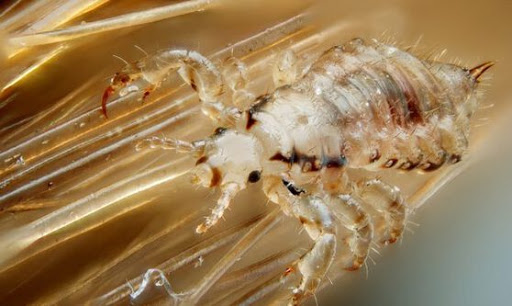 Comb & Cure Lice Removal and Lice Treatment - San Francisco