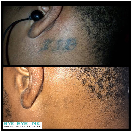 Explore journey tattoo ideas, creative tattoo ideas in Middle Village, available at Bye Bye Ink Laser Tattoo Removal