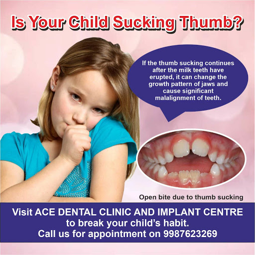 Ace Dental Clinic And Implant Centre