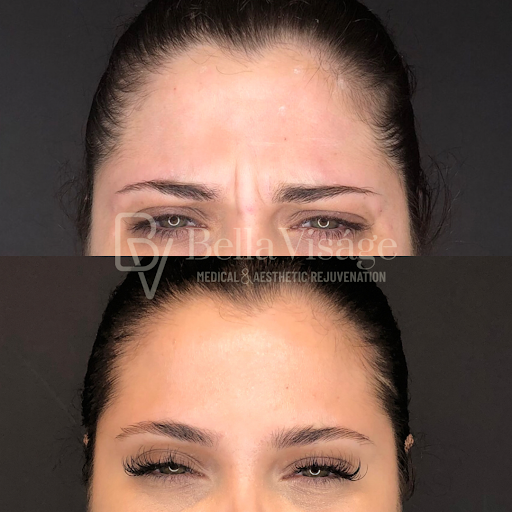 Explore tattoo placing ideas, creative tattoo ideas in Lakeland, available at Bella Visge Medical & Aesthetic Rejuvenation