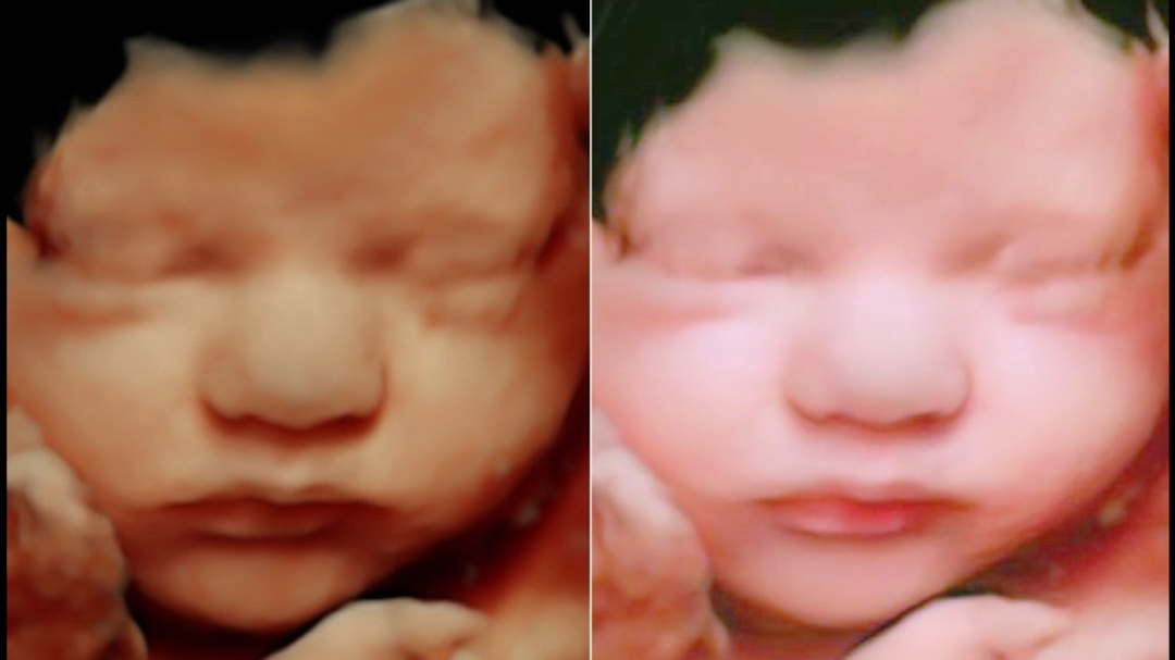 Your 4D Baby - 3D 4D Ultrasound Miami